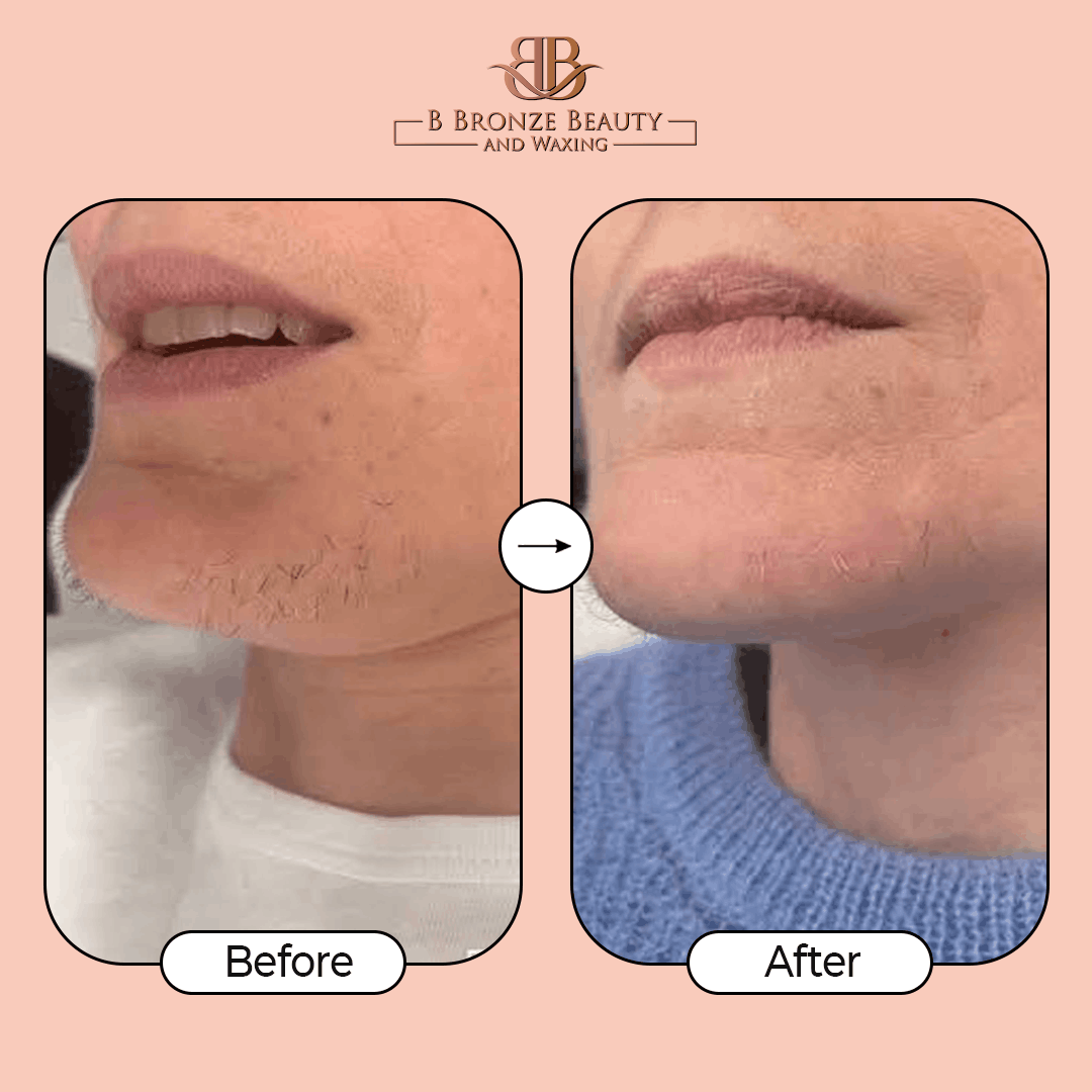 The Bright Skin Treatment Ad, image 8
